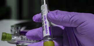 U županiji 7 novooboljelih osoba