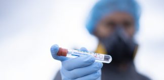 U županiji 19 novooboljelih osoba